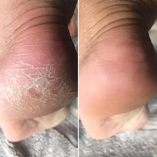 Ana Kovačević rezultat pre i posle