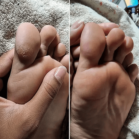 Nikolina Stanković rezultat pre i posle