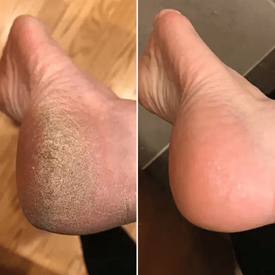 Jelena Tomić rezultat pre i posle